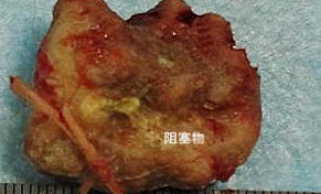 狗狗可以吃荔枝肉嘛
