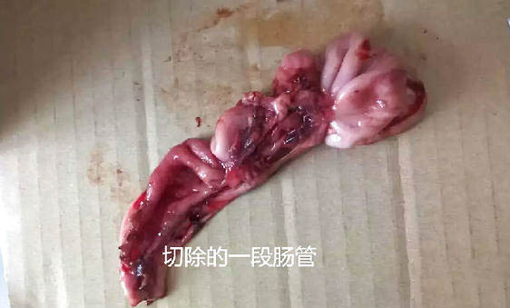 泰迪吃了巧克力症状