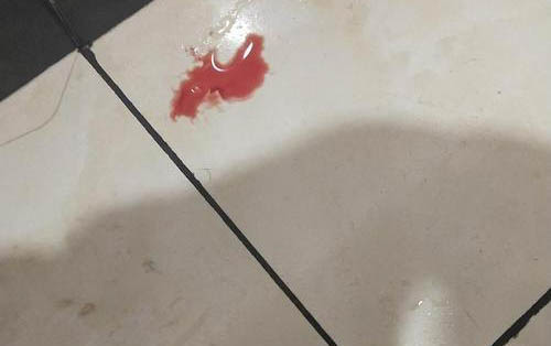 猫咪母鸡坐着肚子疼是什么原因